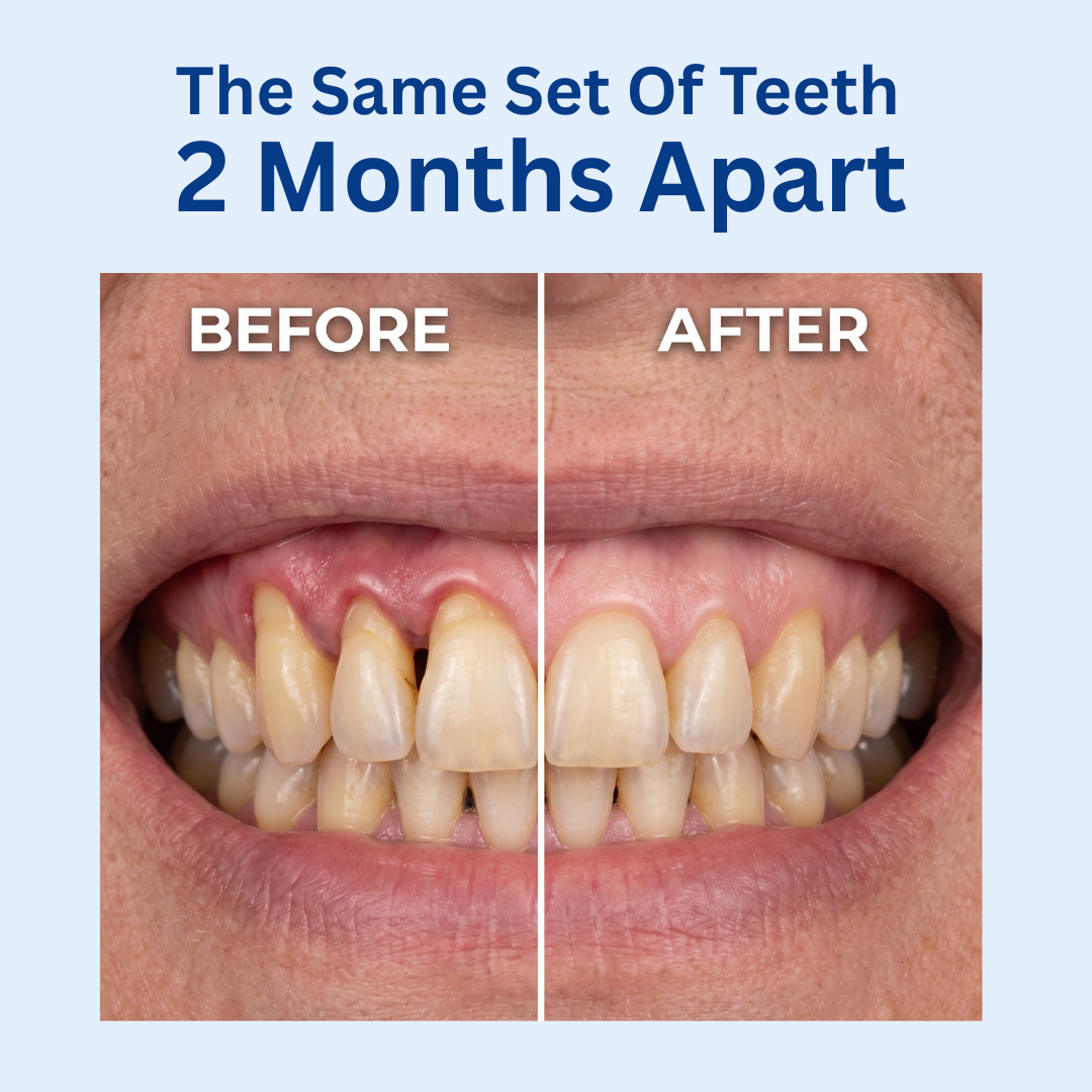 Solene Teeth & Gum Restore Gel