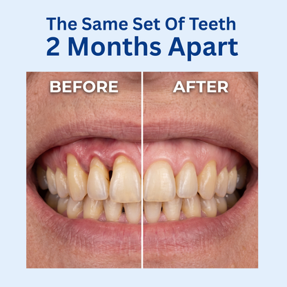 Solene Teeth & Gum Restore Gel